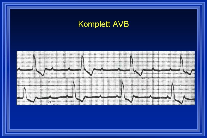 Komplett AVB 