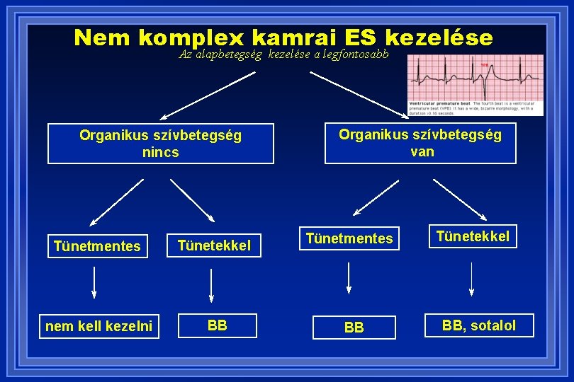 Nem komplex kamrai ES kezelése Az alapbetegség kezelése a legfontosabb Organikus szívbetegség nincs Tünetmentes