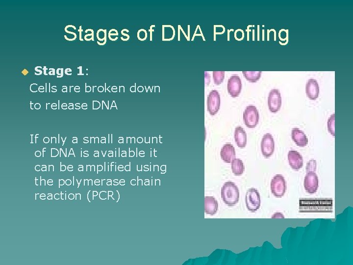 Stages of DNA Profiling Stage 1: Cells are broken down to release DNA u