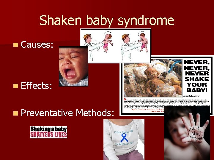 Shaken baby syndrome n Causes: n Effects: n Preventative Methods: 