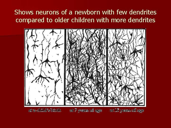 Shows neurons of a newborn with few dendrites compared to older children with more Shows neurons of a newborn with few dendrites compared to older children with more