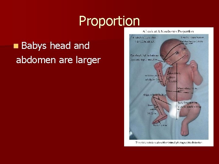 Proportion n Babys head and abdomen are larger Proportion n Babys head and abdomen are larger