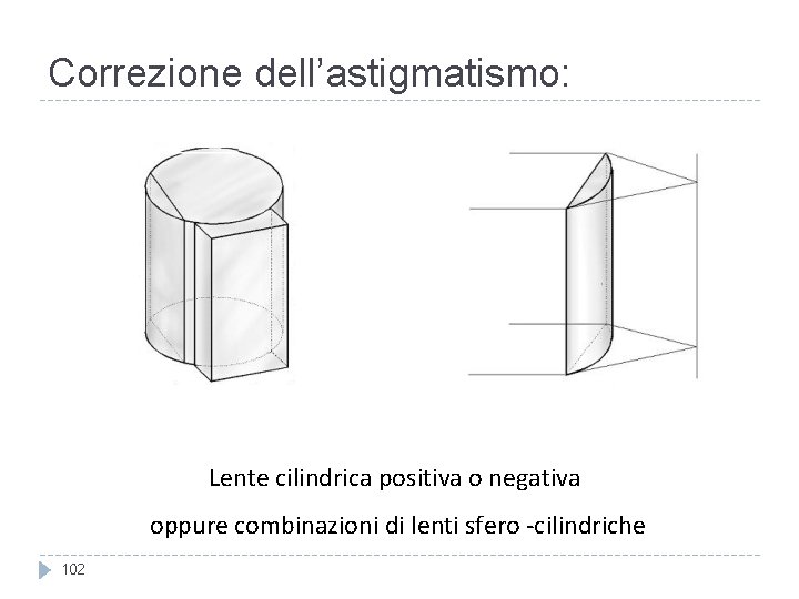 Correzione dell’astigmatismo: Lente cilindrica positiva o negativa oppure combinazioni di lenti sfero -cilindriche 102