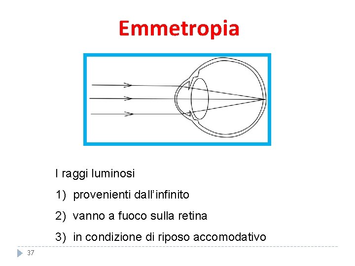 Emmetropia I raggi luminosi 1) provenienti dall’infinito 2) vanno a fuoco sulla retina 3) Emmetropia I raggi luminosi 1) provenienti dall’infinito 2) vanno a fuoco sulla retina 3)