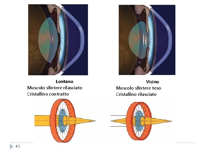 Lontano Muscolo sfintere rilasciato Cristallino contratto 43 Vicino Muscolo sfintere teso Cristallino rilasciato 