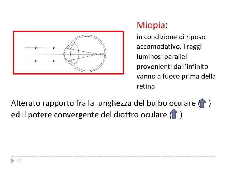 Miopia: in condizione di riposo accomodativo, i raggi luminosi paralleli provenienti dall’infinito vanno a Miopia: in condizione di riposo accomodativo, i raggi luminosi paralleli provenienti dall’infinito vanno a