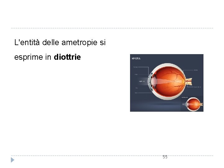 L'entità delle ametropie si esprime in diottrie 55 