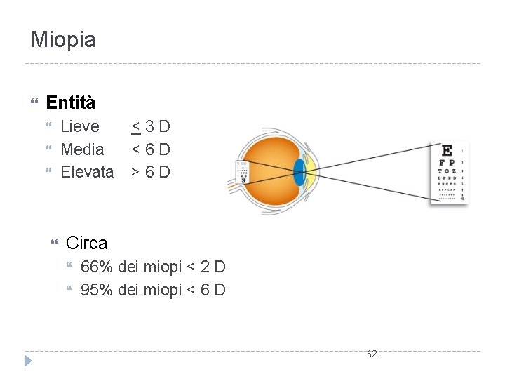 Miopia Entità Lieve Media Elevata < 3 D < 6 D > 6 D