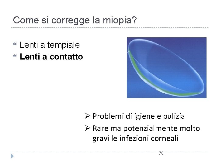 Come si corregge la miopia? Lenti a tempiale Lenti a contatto Ø Problemi di