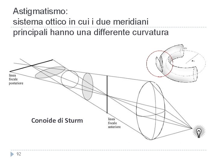 Astigmatismo: sistema ottico in cui i due meridiani principali hanno una differente curvatura Conoide