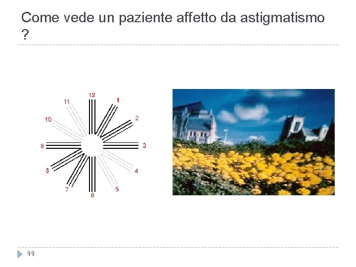 Come vede un paziente affetto da astigmatismo ? 99 