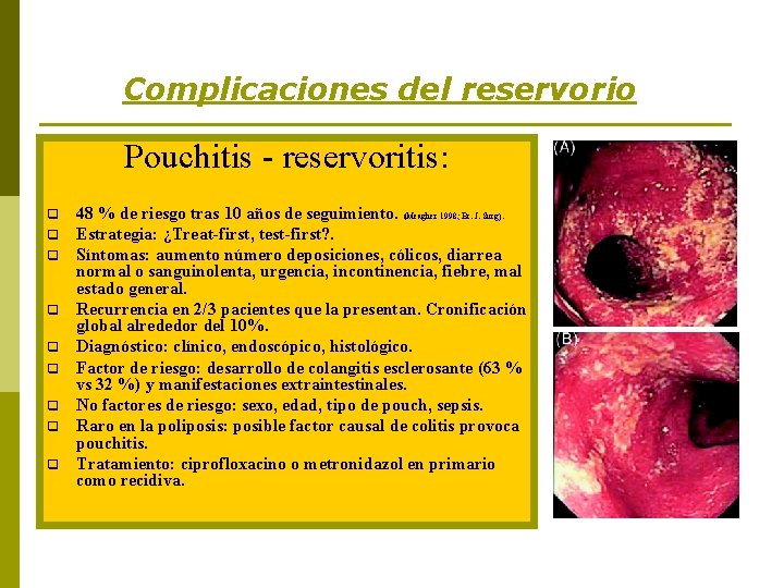 Complicaciones del reservorio Pouchitis - reservoritis: q q q q q 48 % de