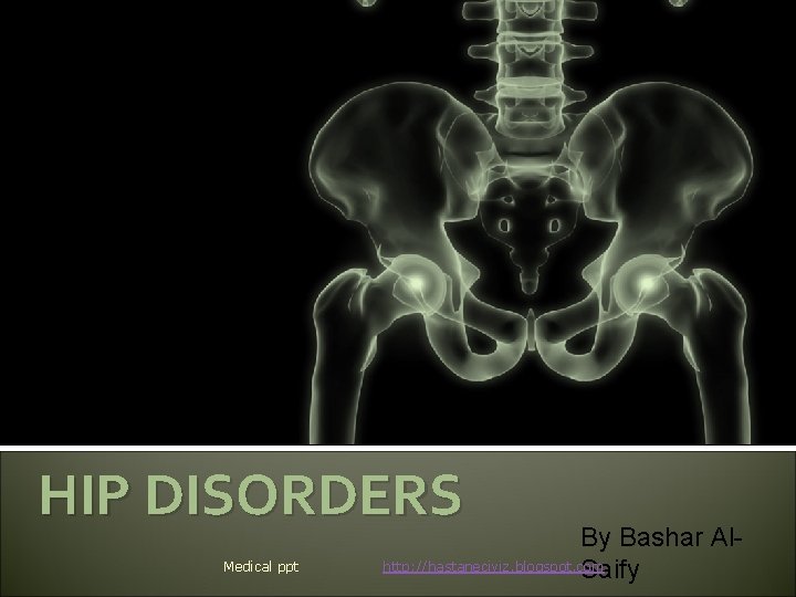 HIP DISORDERS Medical ppt By Bashar Alhttp: //hastaneciyiz. blogspot. com Saify 