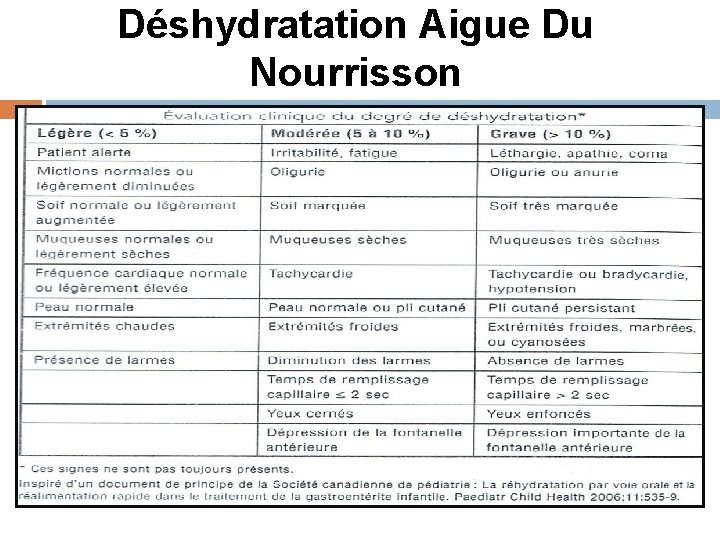 Déshydratation Aigue Du Nourrisson 