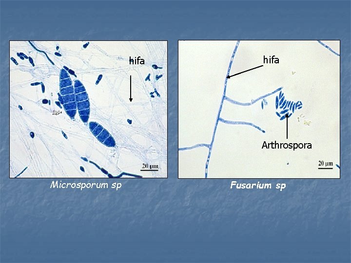 hifa Arthrospora Microsporum sp Fusarium sp 
