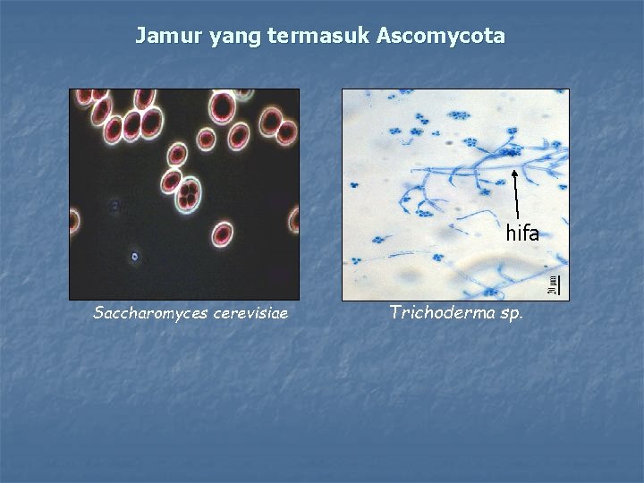 Jamur yang termasuk Ascomycota hifa Saccharomyces cerevisiae Trichoderma sp. 