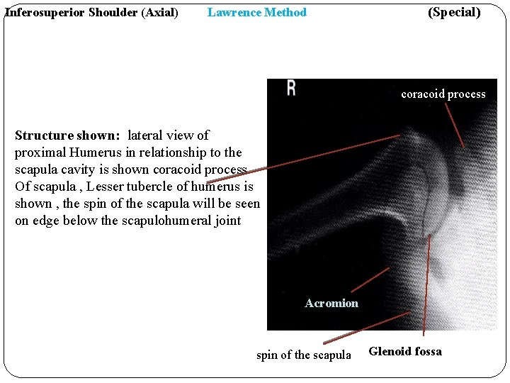 Inferosuperior Shoulder (Axial) Lawrence Method (Special) coracoid process Structure shown: lateral view of proximal