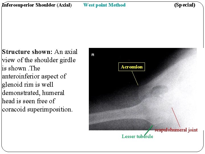 Inferosuperior Shoulder (Axial) Structure shown: An axial view of the shoulder girdle is shown.
