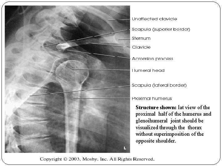 Structure shown: lat view of the proximal half of the humerus and glenoihumeral joint