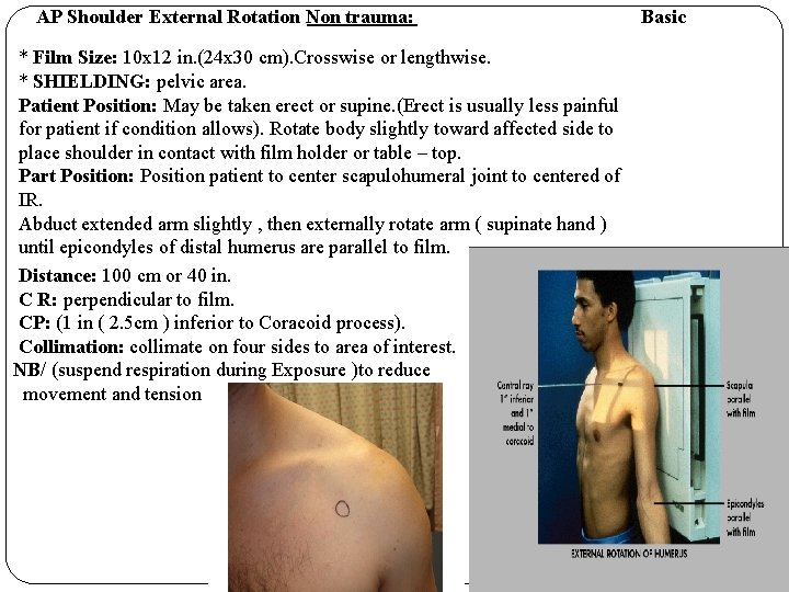 AP Shoulder External Rotation Non trauma: * Film Size: 10 x 12 in. (24