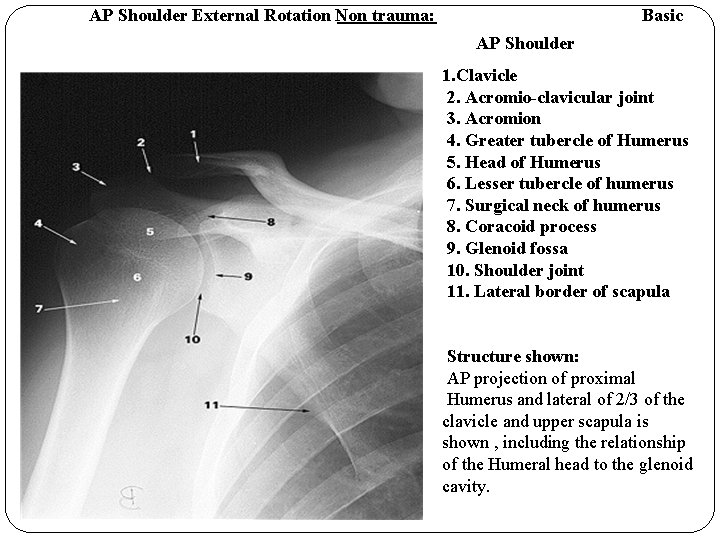 AP Shoulder External Rotation Non trauma: Basic AP Shoulder 1. Clavicle 2. Acromio-clavicular joint