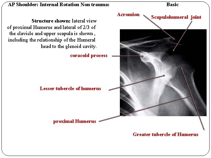 AP Shoulder: Internal Rotation Non trauma: Basic Acromion Structure shown: lateral view of proximal