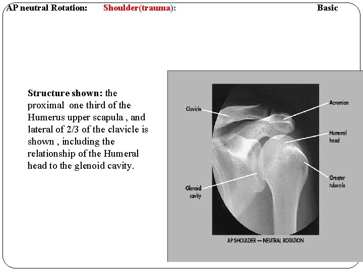 AP neutral Rotation: Shoulder(trauma): Structure shown: the proximal one third of the Humerus upper