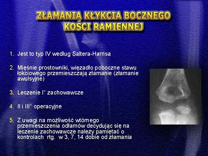 1. Jest to typ IV według Saltera-Harrisa 2. Mięśnie prostowniki, więzadło poboczne stawu łokciowego