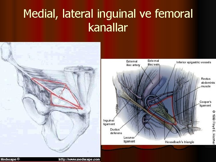 Medial, lateral inguinal ve femoral kanallar 