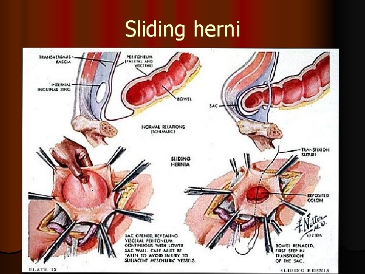 Sliding herni 