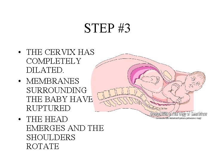 STEP #3 • THE CERVIX HAS COMPLETELY DILATED. • MEMBRANES SURROUNDING THE BABY HAVE