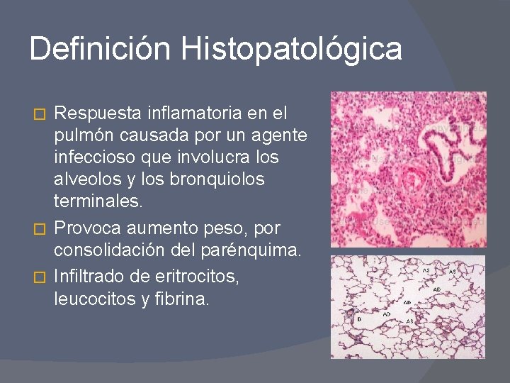 Definición Histopatológica Respuesta inflamatoria en el pulmón causada por un agente infeccioso que involucra