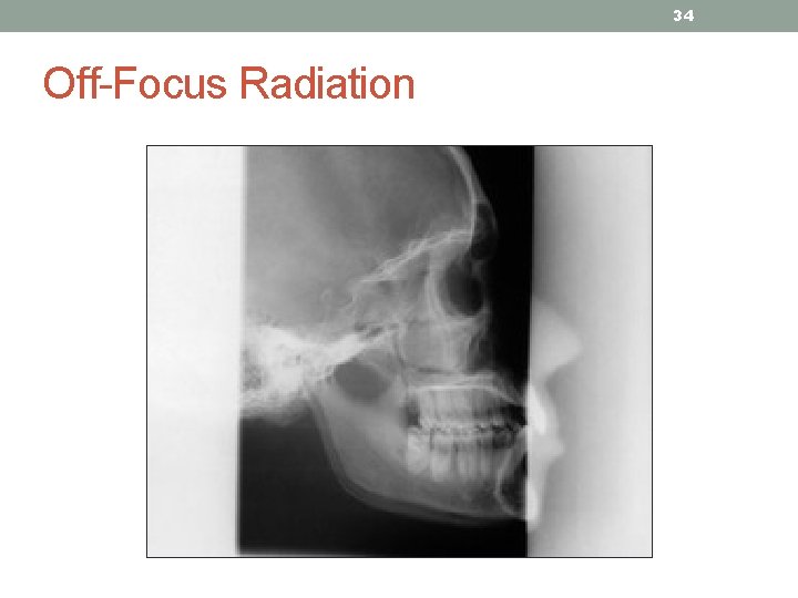 34 Off-Focus Radiation 