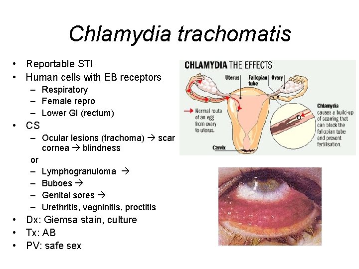 Chlamydia trachomatis • Reportable STI • Human cells with EB receptors – Respiratory –