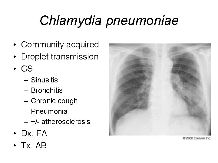 Chlamydia pneumoniae • Community acquired • Droplet transmission • CS – – – Sinusitis