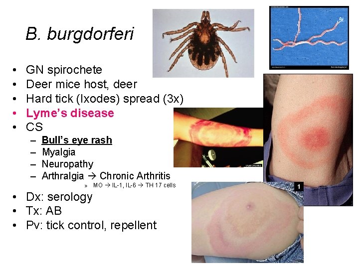 B. burgdorferi • • • GN spirochete Deer mice host, deer Hard tick (Ixodes)