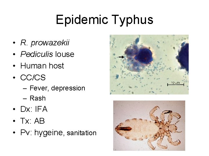 Epidemic Typhus • • R. prowazekii Pediculis louse Human host CC/CS – Fever, depression