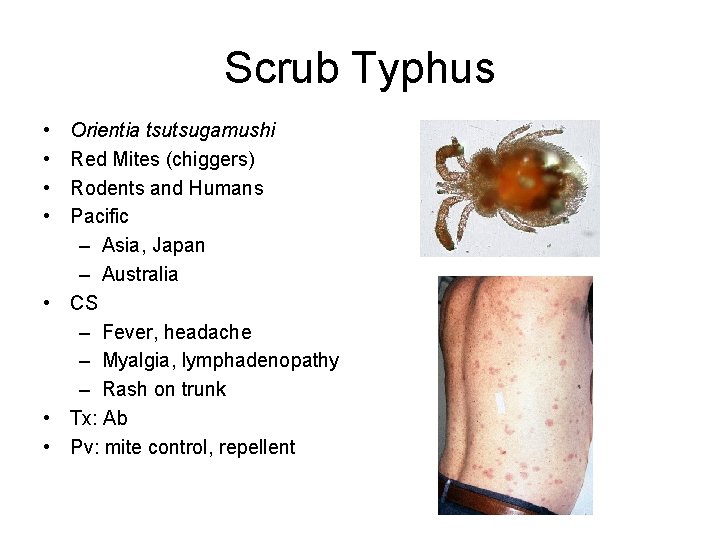 Scrub Typhus • • Orientia tsutsugamushi Red Mites (chiggers) Rodents and Humans Pacific –