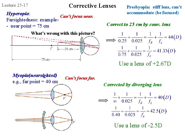 Corrective Lenses Lecture 25 -17 Hyperopia: Can’t focus near. Farsightedness: example- near point =