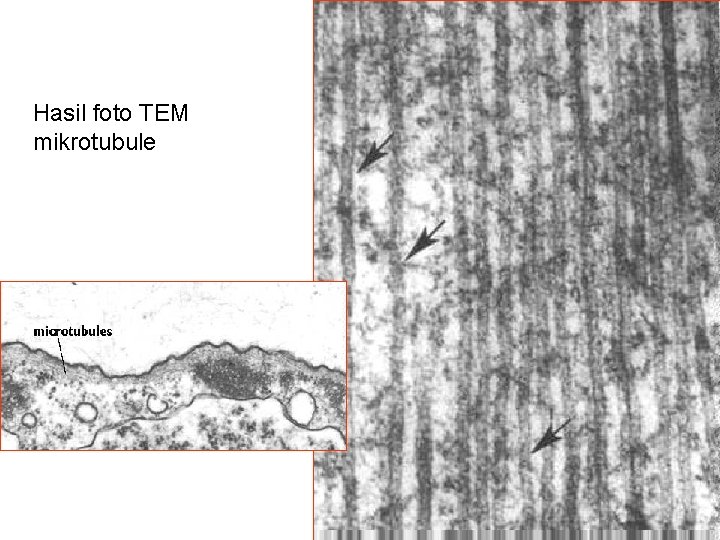 Hasil foto TEM mikrotubule 