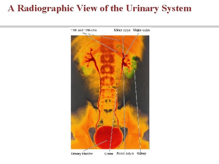 A Radiographic View of the Urinary System 