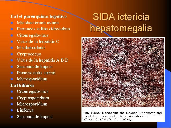 Enf el parenquima hepático l Micobacterium avium l Farmacos sulfas zidovudina l Citomegalovirus l