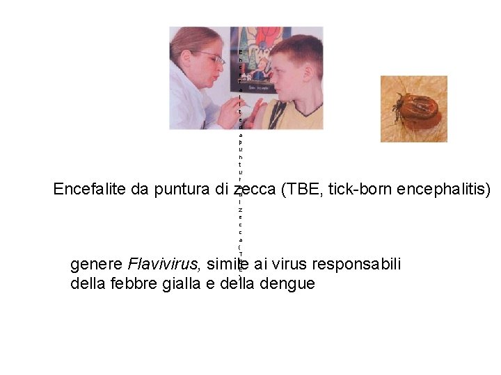 E n c e f a l i t e d a p u