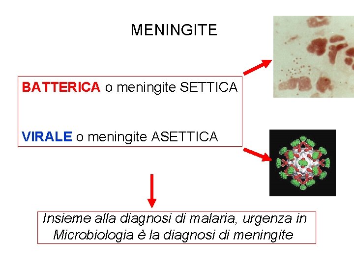 MENINGITE BATTERICA o meningite SETTICA VIRALE o meningite ASETTICA Insieme alla diagnosi di malaria,