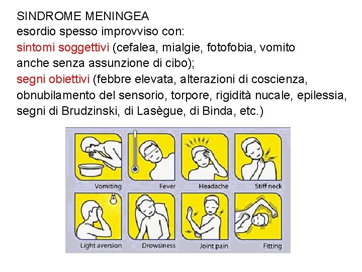SINDROME MENINGEA esordio spesso improvviso con: sintomi soggettivi (cefalea, mialgie, fotofobia, vomito anche senza