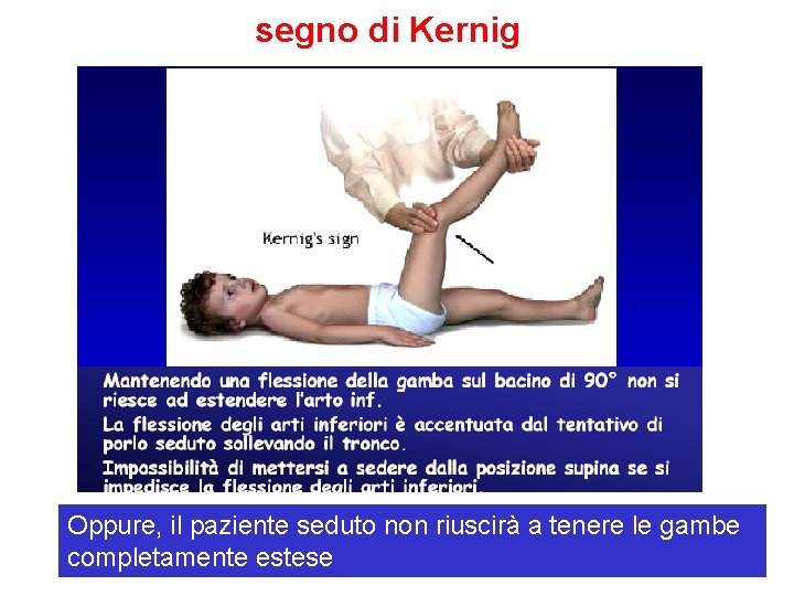 segno di Kernig Oppure, il paziente seduto non riuscirà a tenere le gambe completamente