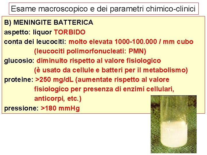 Esame macroscopico e dei parametri chimico-clinici B) MENINGITE BATTERICA aspetto: liquor TORBIDO conta dei