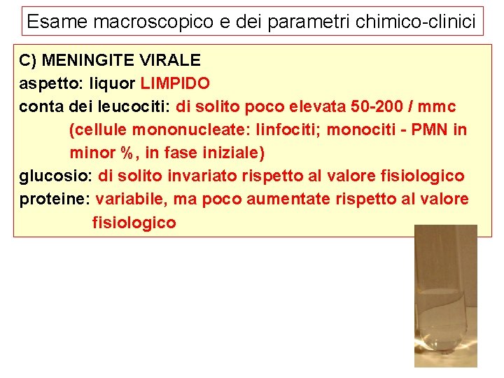 Esame macroscopico e dei parametri chimico-clinici C) MENINGITE VIRALE aspetto: liquor LIMPIDO conta dei