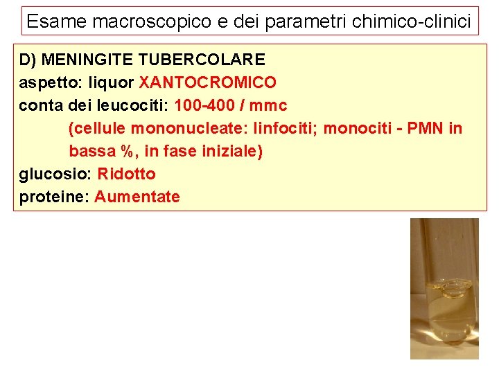 Esame macroscopico e dei parametri chimico-clinici D) MENINGITE TUBERCOLARE aspetto: liquor XANTOCROMICO conta dei