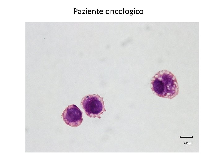 Paziente oncologico 
